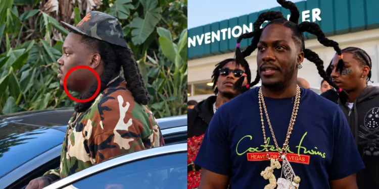 Lil Yachty reacciona al enterarse de que LUCKI fue apuñalado en ComplexCon